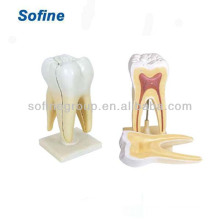 Dental Teaching/Study Model,Human Teeth Model,Dental Model